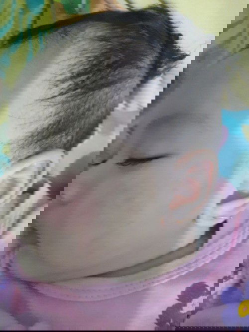 Gatal di pipi di beri salep atau obat ap?