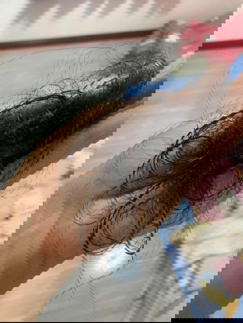 ผมร่วงหนักมากกกกกกกก