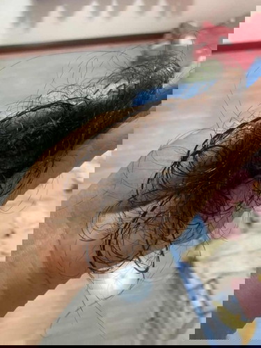 ผมร่วงหนักมากกกกกกกก