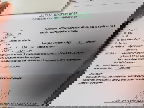 alin pong date ng EDD ang susundin ko para maka apply ng Maternity Leave sa SSS?