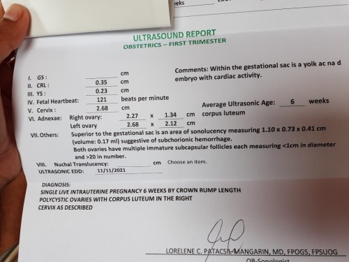 alin pong date ng EDD ang susundin ko para maka apply ng Maternity Leave sa SSS?