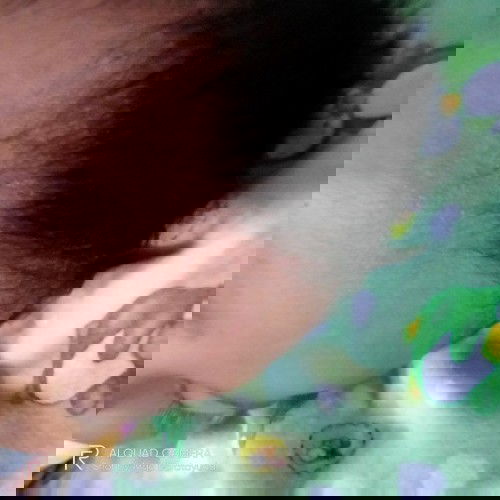 Bruntusan di kepala dan jidat😭