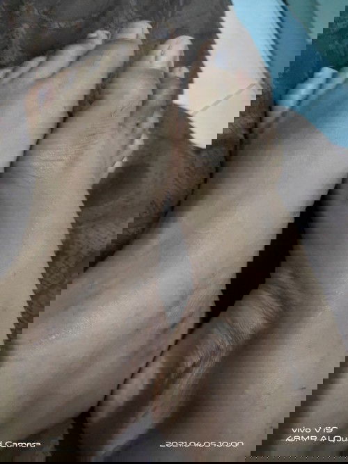 Dok 
Saya mau tanyk 
Knp ya kaki saya gatal² tiap malam jdi buat tergangu saya tdur ajh dok ?