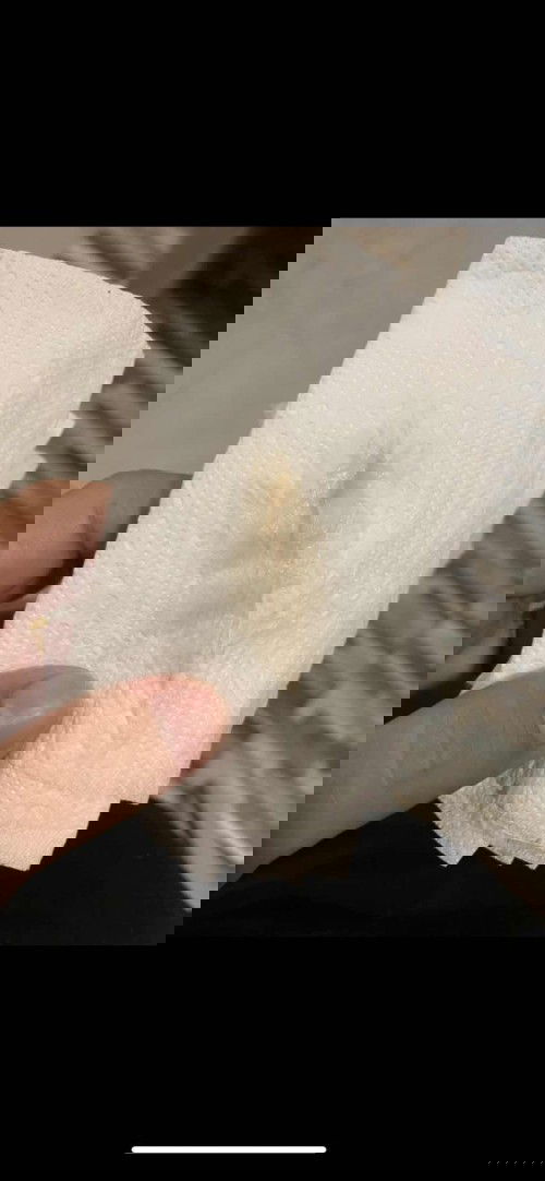 กระตุ้นปากมดลูก