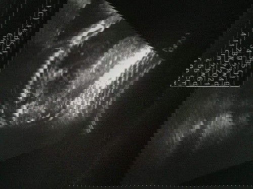 เเม่ๆมาช่วยดูให้หน่อยค่ะชรึญ​