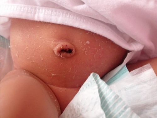 Ano po pwede i apply dito? Or may iaapply ba o hayaan na lng?