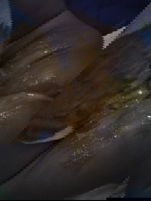 ถ่ายปกติไหม