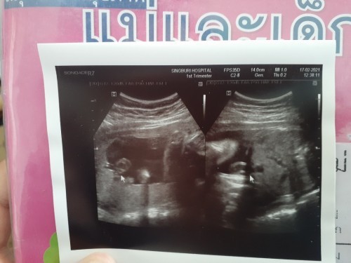 ตื่นเต้นจังค่ะใกล้แล้ว