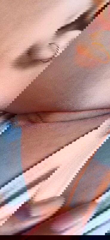 Leher merah +biang keringat