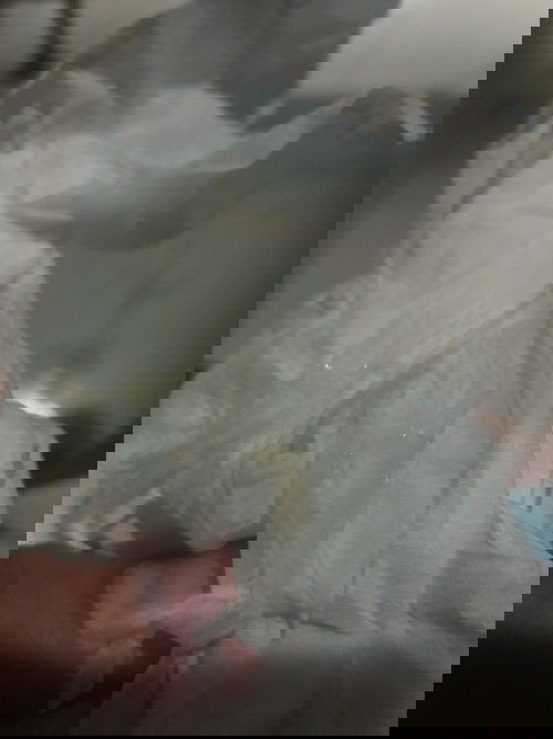 มีมูกสีออกเหลืองไม่ปวดท้อง