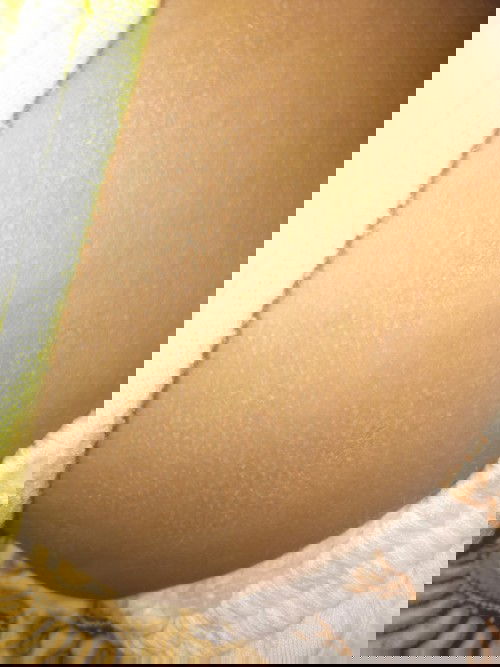 Bruntus di badan bayi