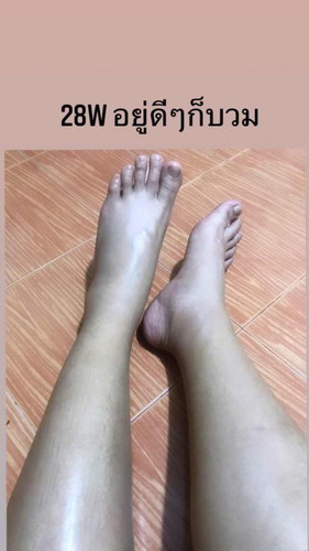 28W อยู่ดีๆก็บวม อยากอาเจียน ทั้งๆที่ไม่เคยแพ้ท้องเลย