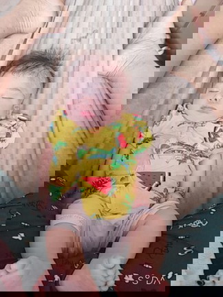 Sanh mổ liệu 4 tháng 1 tuần vết thưog đã lành chưa?