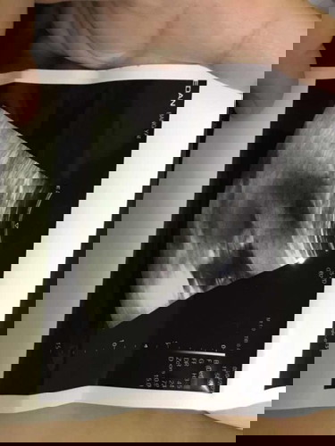 อัลตร้าซาวน์5เดือน แบบนี้ช่วยดูหน่อยมั้ยค่ะว่าลูกเป็นปากแหว่งเพดานโหว่มั้ย