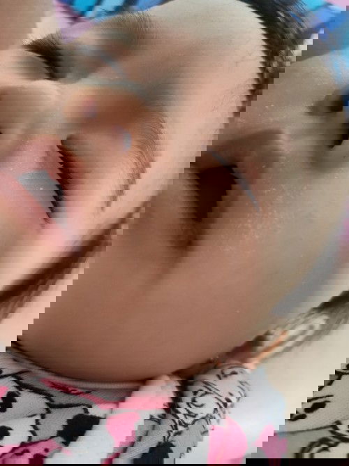 Dry and peeling skin