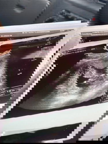 Lil bb in 12 weeks