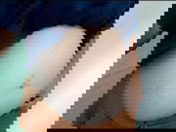 ท้องแตกไหมค่ะ