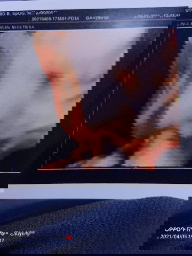 Halo bun di sini ada yg hpl nya bulan juni? Insya allah saya akan lahir di bulan juni😇