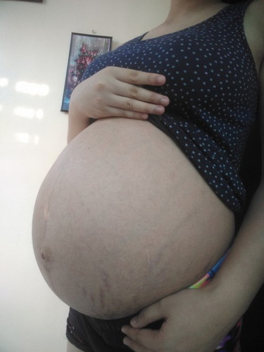 38weeks and 3days