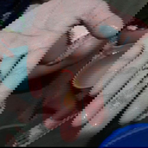 Evening Primrose or mucus plug?