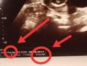 ตอบที่นะคะ