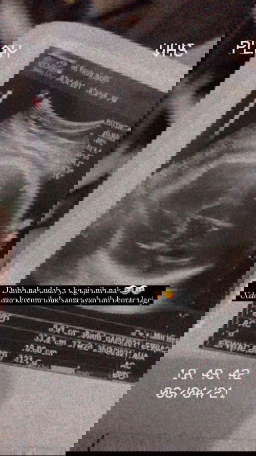 Bbj naik signifikan selama 2minggu usia 36week