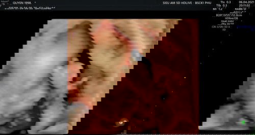 Có Trâu nào như con em ko SA lần nào cũng lấy tay che mặt hết ko muốn cho ba mẹ thấy mặt ấy.
Trâu T7