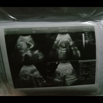 25 week 1 d adakah yang udah turun dedek nya,