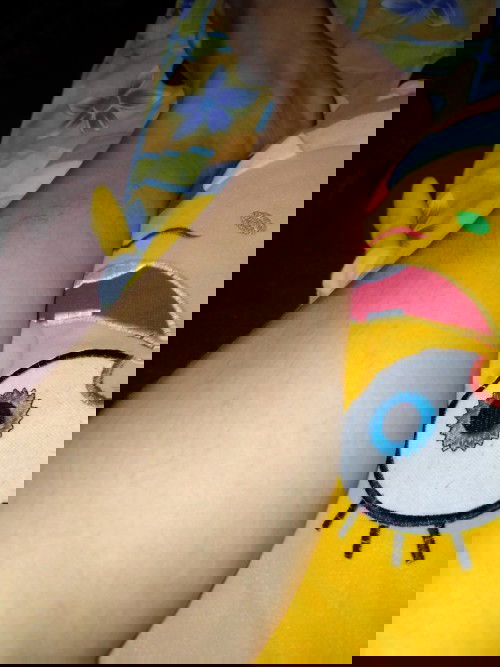 Betis keras dan nyeri