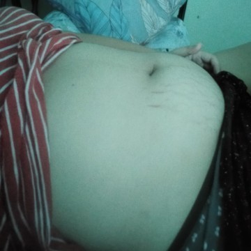 20 weeks tummy