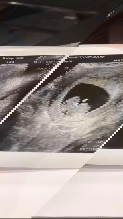 แม่ๆบ้านไหนคลอดเดือนตุลาบ้างคะ 
ตอนนี้เรา10weekแล้วค่ะ  ใครคลอดเดือนตุลาบ้างคะ💕