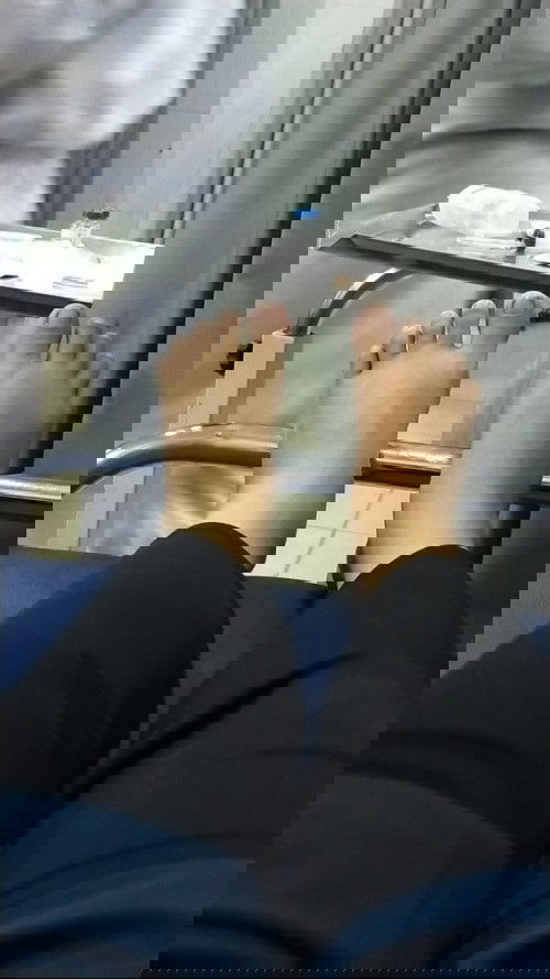 Kaki bengkak pascaoperasi SC