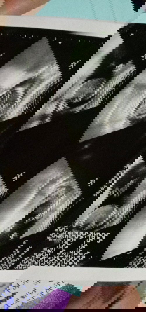 Alhamdulillah usg pertama kali