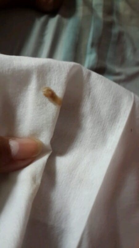 มีแบบนี้ออกมาค่ะ 38+2. คืออะไรจ้า ขอถามหน่อย คืิอจะคลอด หรือยังค่ะ ออกตั้งแต่เมื่ิอคืนค่ะ