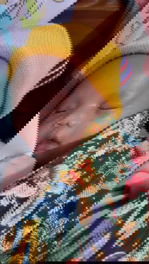 Mata bayi keluar cairan kuning