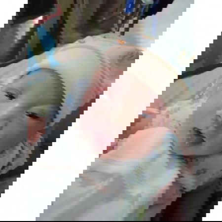 ครรภ์เป็นพิษ