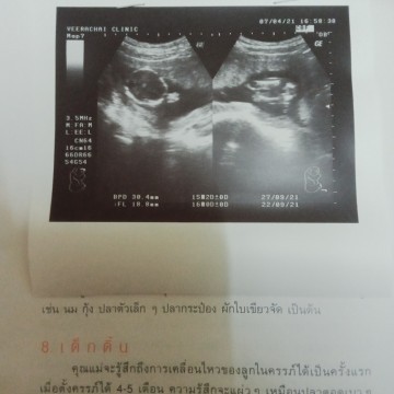 16week. วันนี้ไปซาวหมอบอกว่าน่าจะเป็นผู้หญิง มีแม่ๆคนไหนพอจะมองออกบ้างไหมค่ะว่า หญิงจริงๆไหม 1