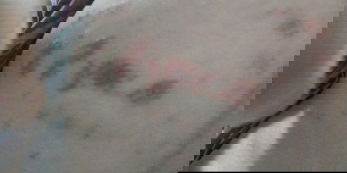 ผื่นคัน ในคนท้อง แม่ท้องท่านเป็นบ้างค่ะ