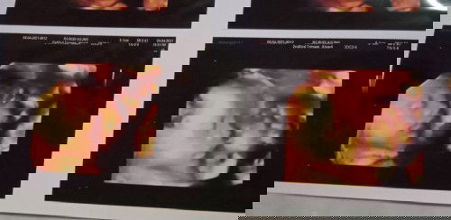 Berat badan janin besar