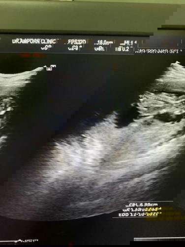 เช็คราคา ตรวจ nifty ลพบุรี