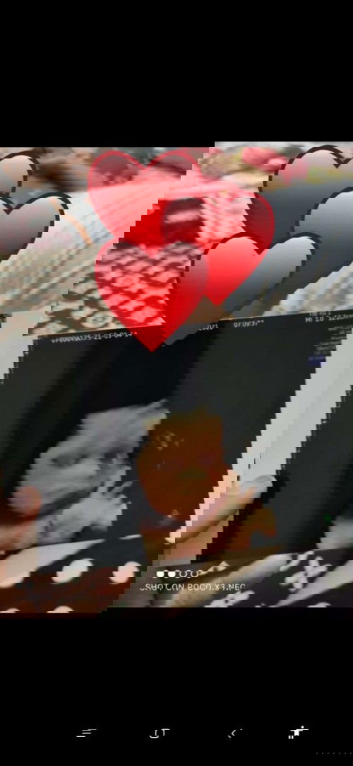 Share pengalaman vbac dong bun...