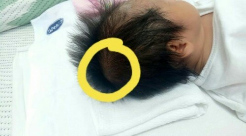 Normal po ba ito?
