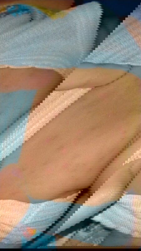 halo bund mohon bantu saya bintik merah