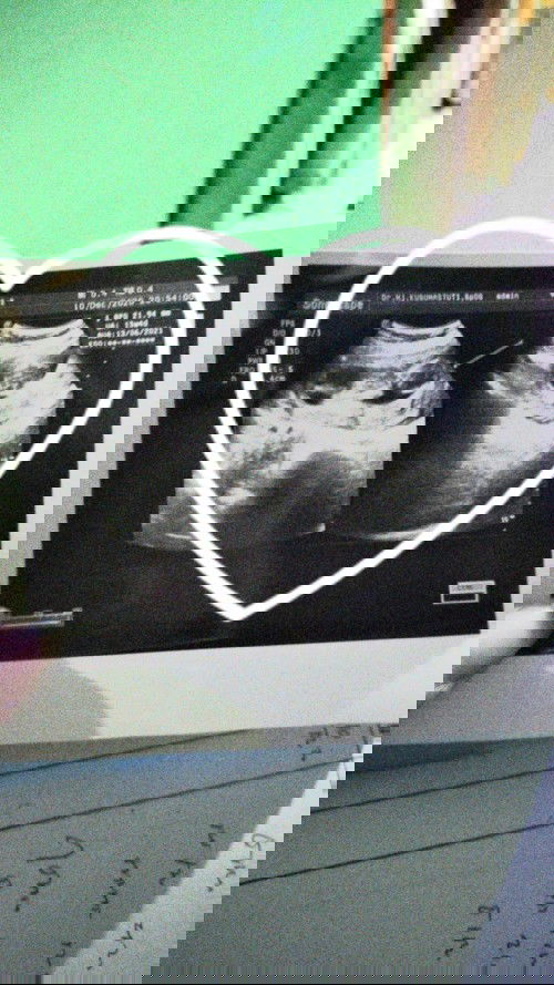 riskalistiana714@gmail.com