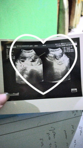 riskalistiana714@gmail.com