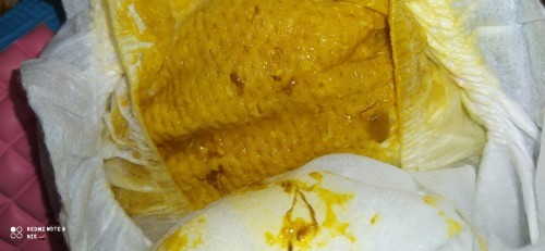 Bayi berak cair