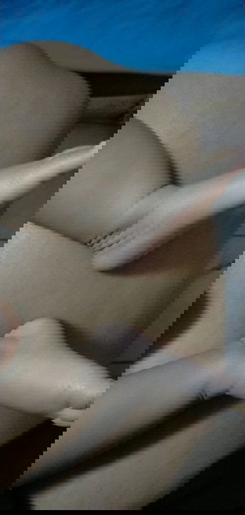 ขาน้องไม่เท่ากัน