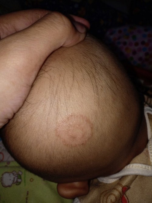Kepala bayi ada lingkaran merah