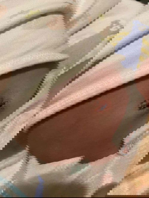 น้องมีเลือดออกจากสะดือ คืออะไรหรอคะ พึ่งเห็นเลยคะ แต่น้องไม่งอแงคะ