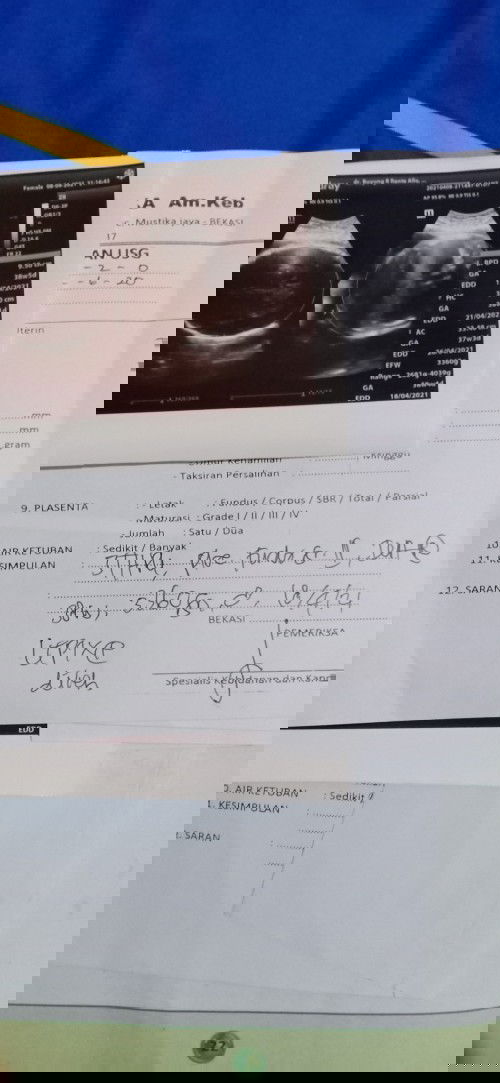 Hpl di USG atau di aplikasi tap